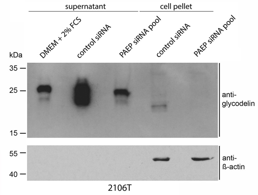 2106T were transfected with a pool of four different PAEP-specific siRNAs for 72h.jpg